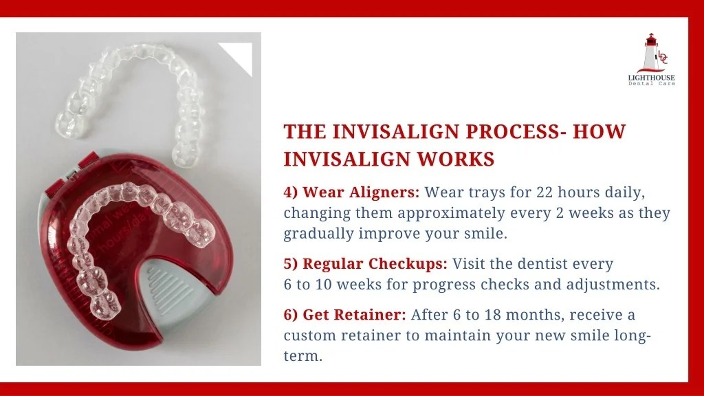 PPT How Does Invisalign Work? PowerPoint Presentation, free download