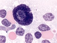 Mast Cell 1.