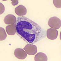 Cytoplasmic Granulation Toxic