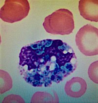 Bluegreen Crystal inclusions