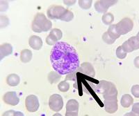 Cytoplasmic Granulation Toxic