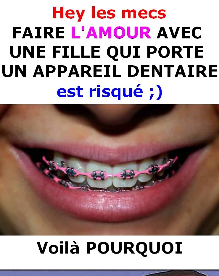 L’amour avec une fille qui porte un appareil dentaire !!! Image Lien