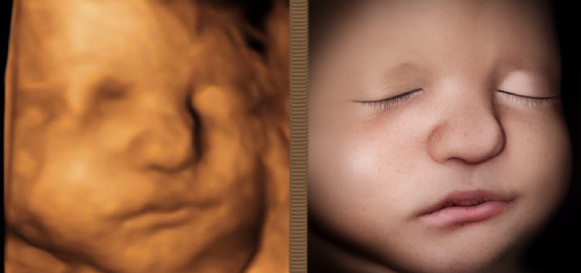 8K Image Enhancement Image of a Miracle 4D Ultrasound Center