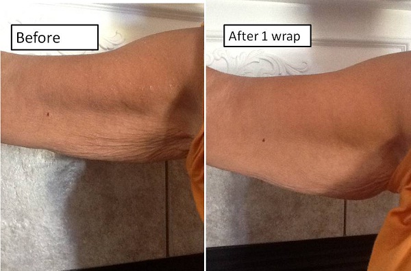 Most Expensive Plastic Surgeries In The World