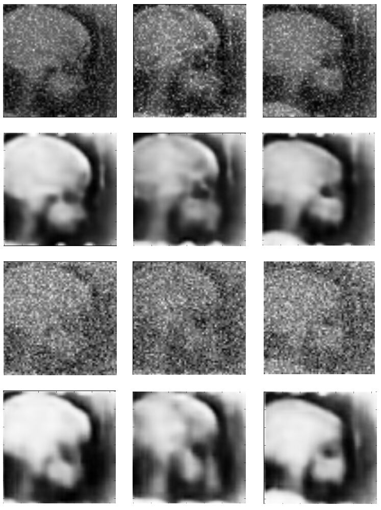 Medical image denoising using convolutional denoising autoencoders DeepAI