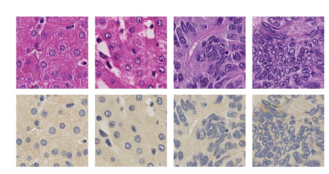 GANbased Virtual ReStaining A Promising Solution for Whole Slide Image Analysis DeepAI
