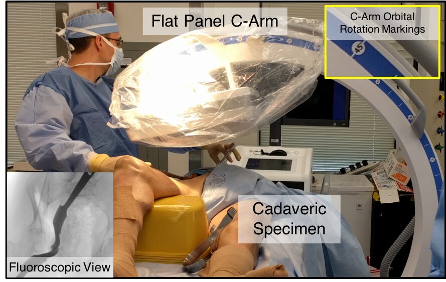 Pose Estimation of Periacetabular Osteotomy Fragments with