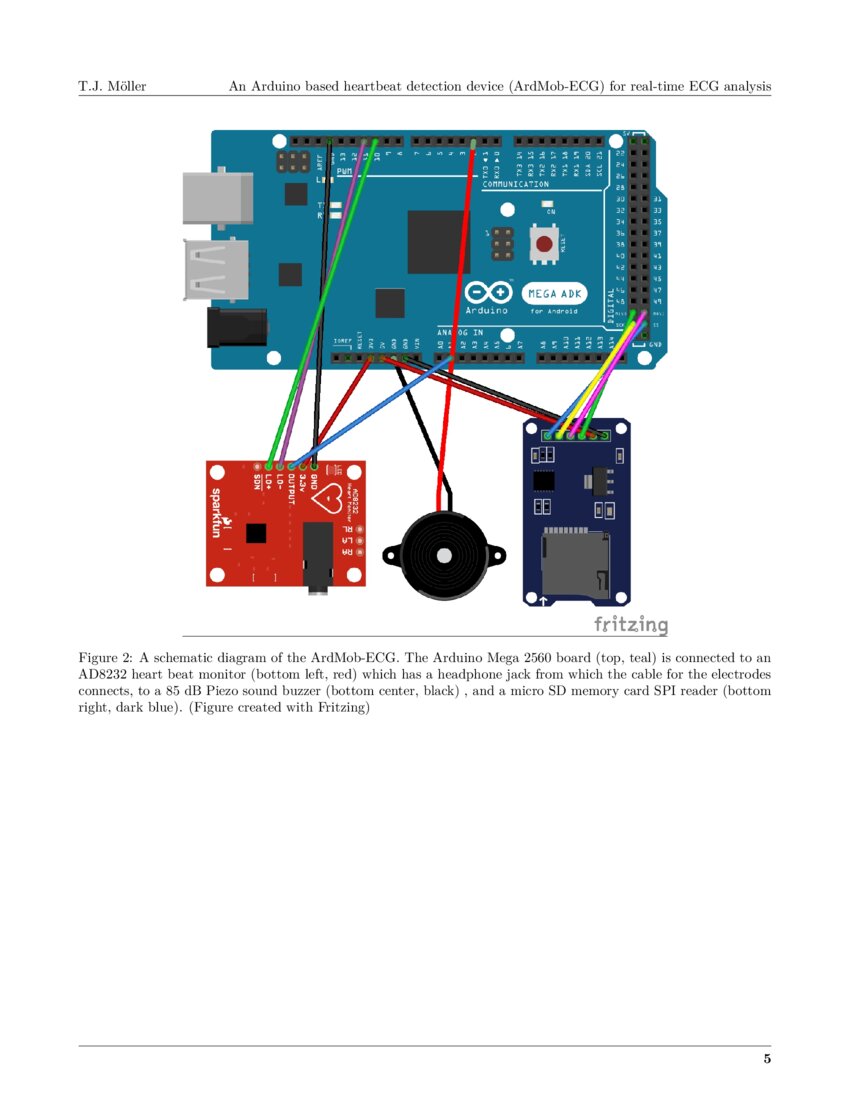 An Arduino based heartbeat detection device (ArdMobECG) for realtime