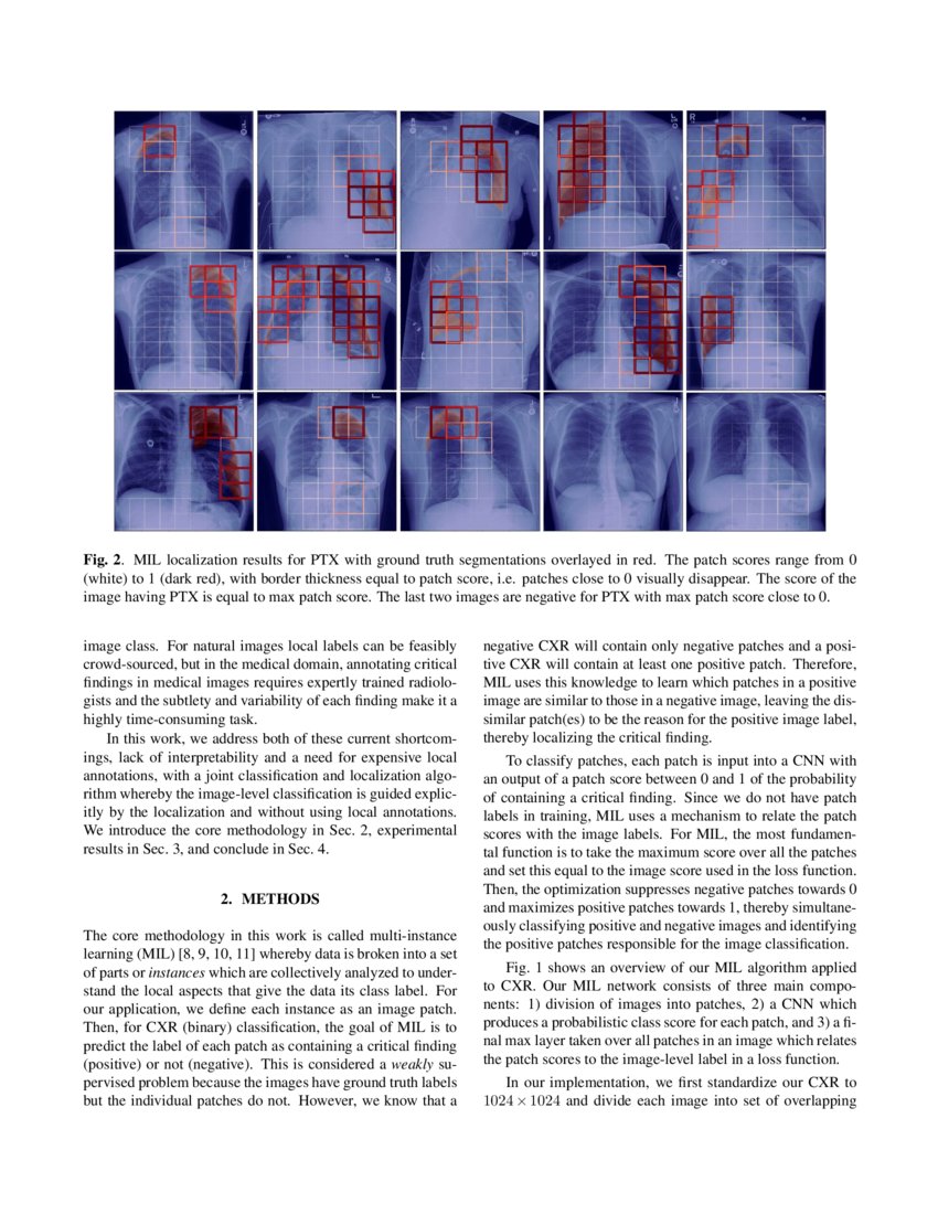 Localization of Critical Findings in Chest XRay without Local Annotations Using MultiInstance