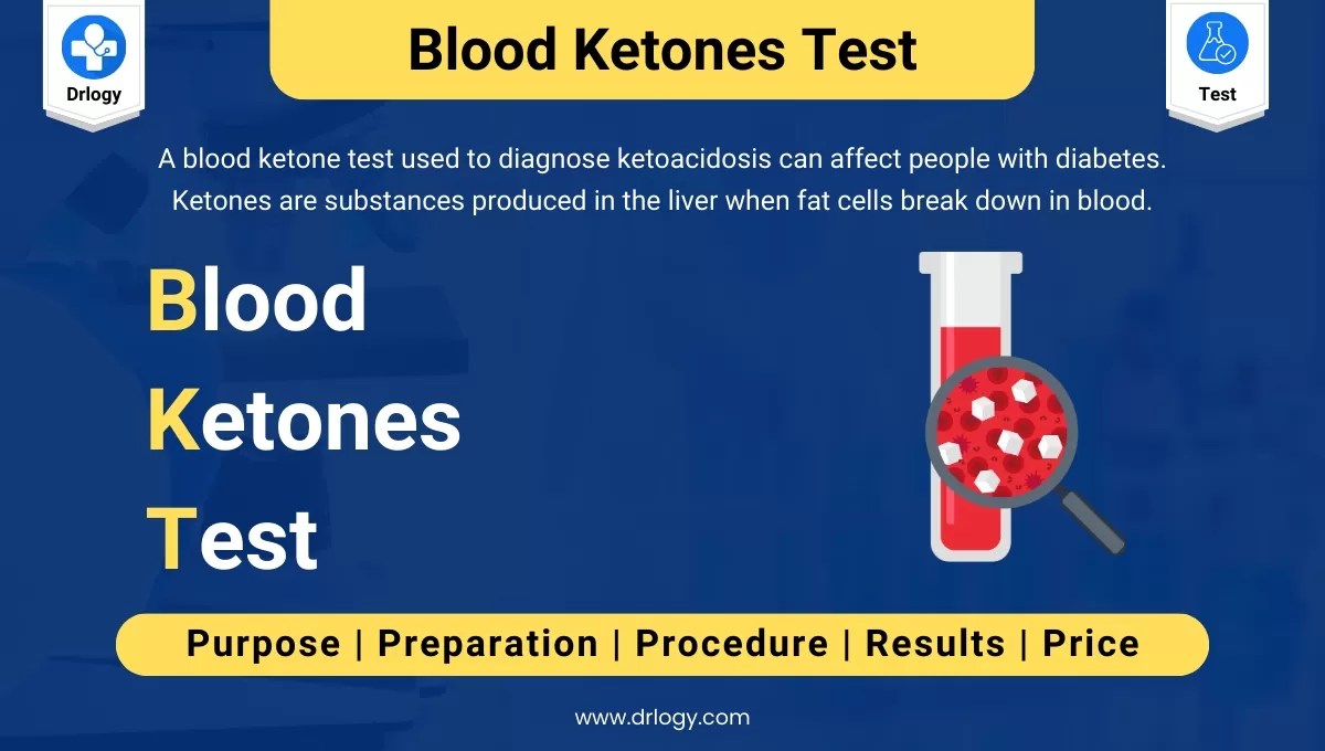 Blood Ketones Test Price, Purpose, Procedre and Results Drlogy