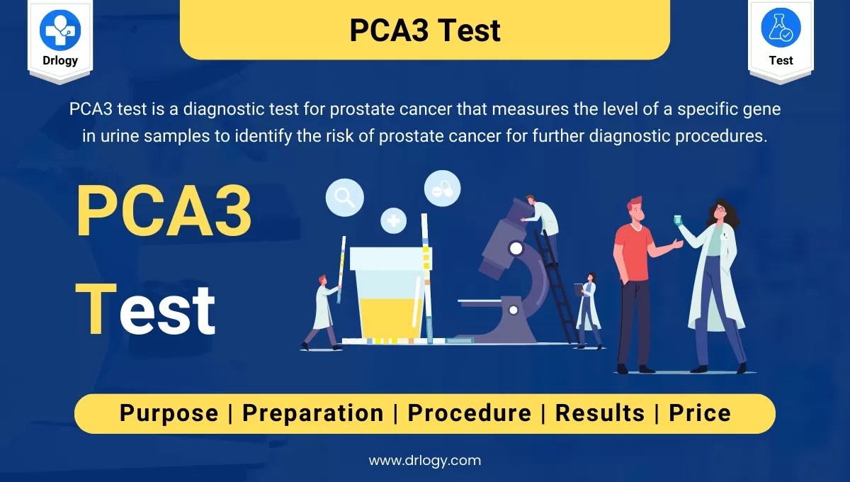 PCA3 Test: Price, Purpose and Results - Drlogy