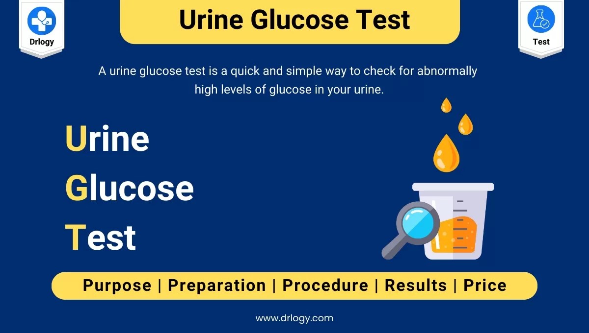 Urine Glucose Test: Meaning, Types, Purpose & Results | Drlogy