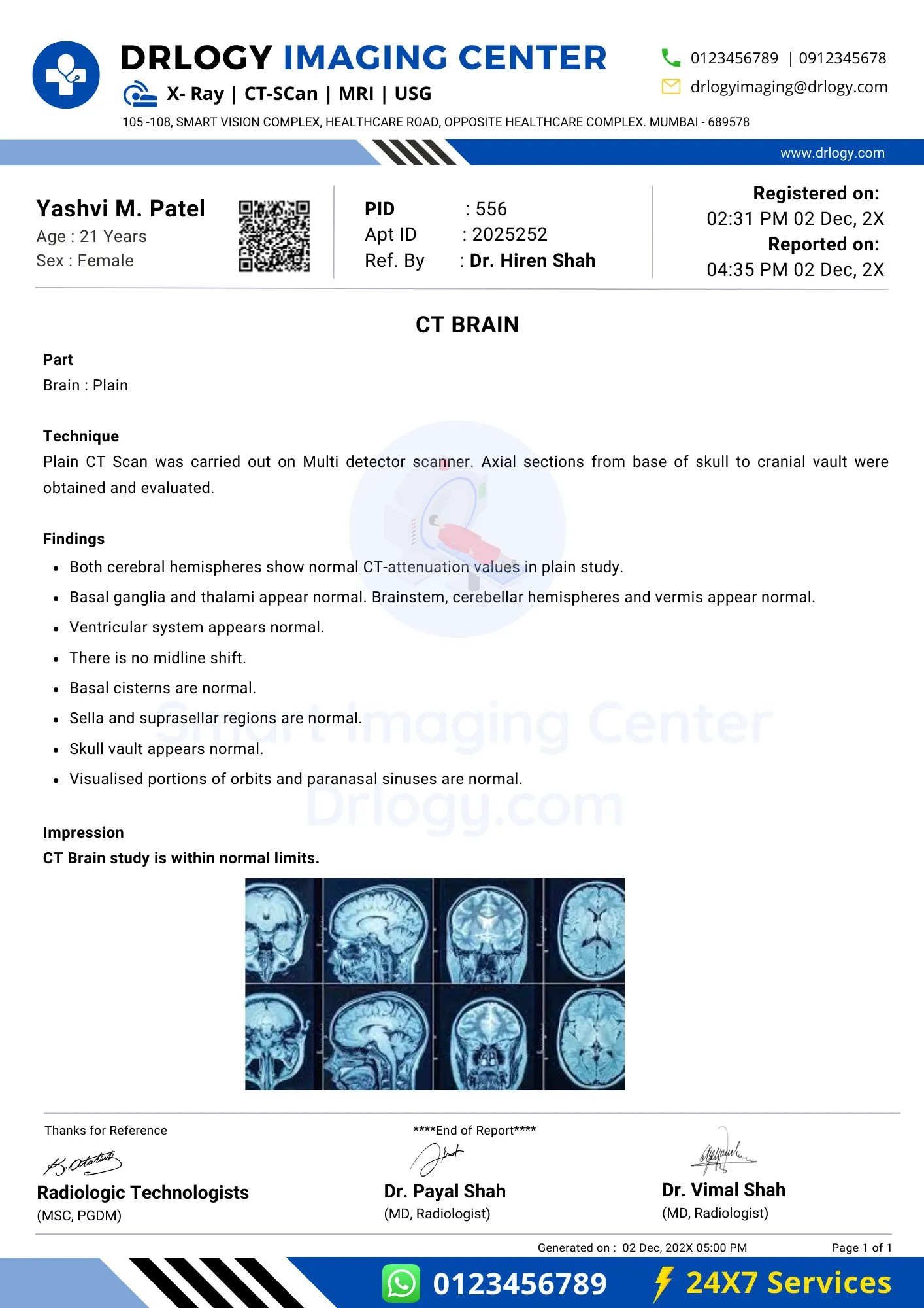 Brain CT Scan Report Format 10 Key Clinical Guidelines & Example Drlogy
