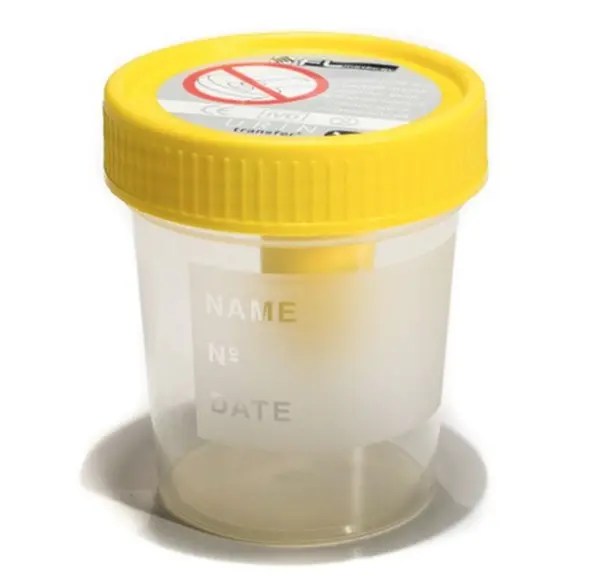 Pot de prélèvement pour urine 120 ml bouchon jaune stérile en