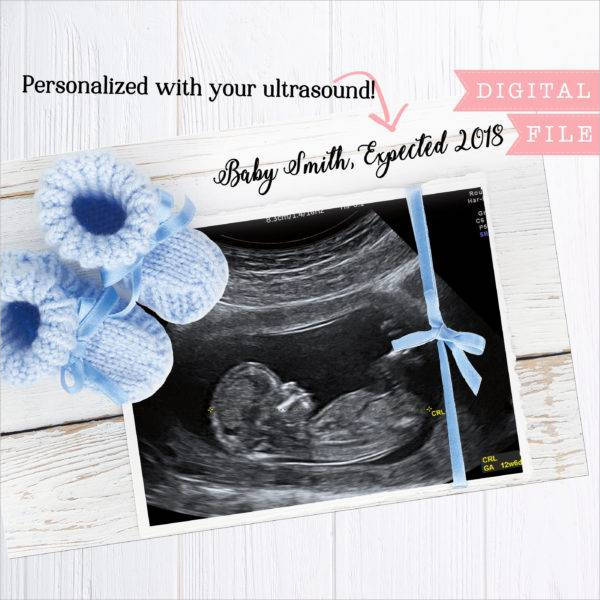 16+ Pregnancy Announcement Designs & Examples - Psd, Ai | Examples