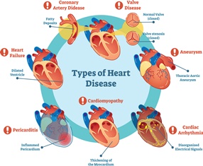 SSDI Benefits for Cardiovascular Disease | Alperin Law