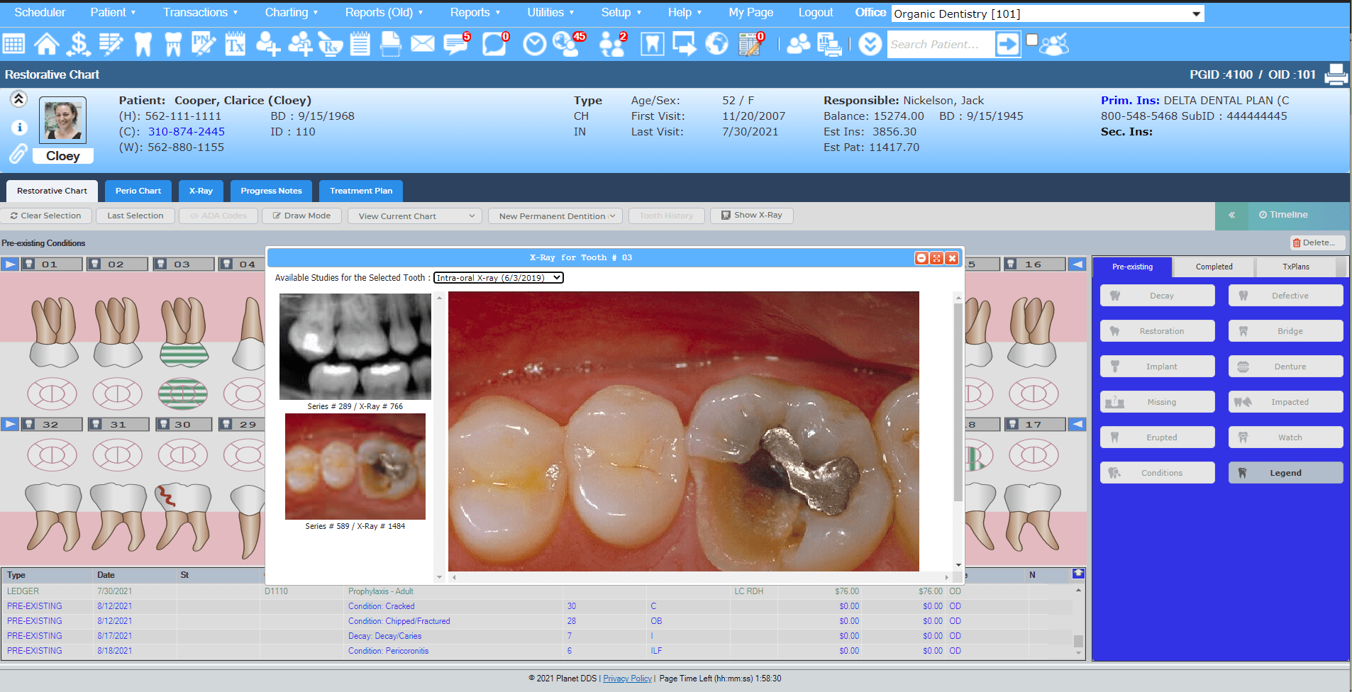 Denticon vs. Dentrix G2