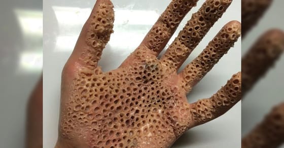 Warning Do Not Look At These Photos If You're Afraid Of Holes What's