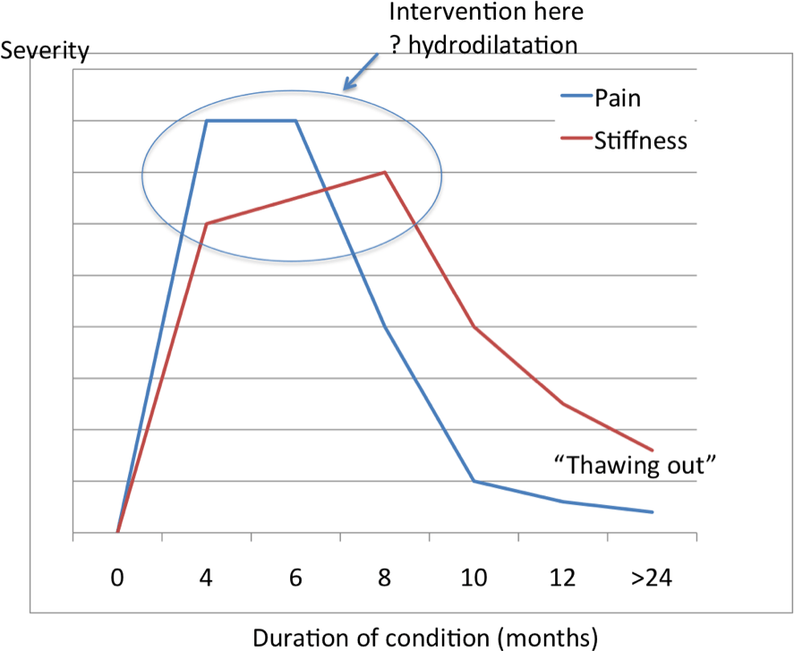 Treating Frozen Shoulder