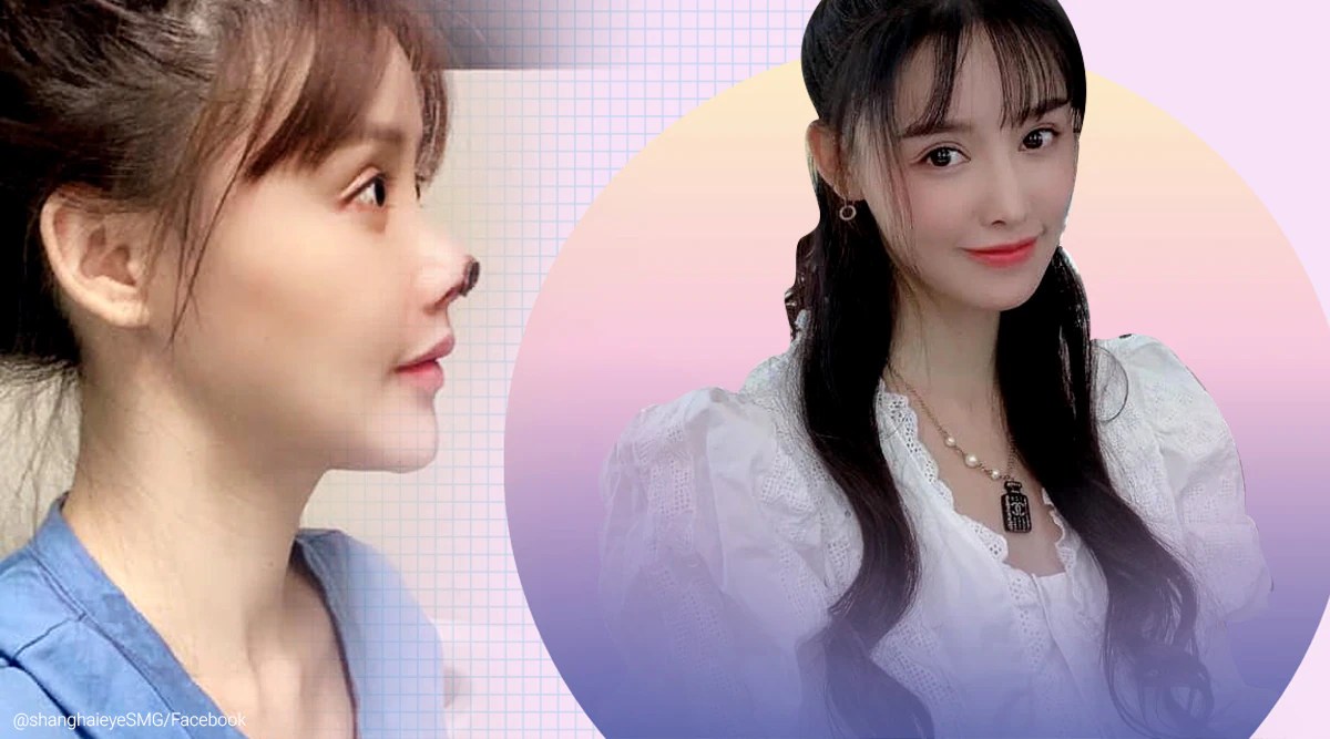 Plastic surgery gone wrong, Chinese actor shares pictures of damaged