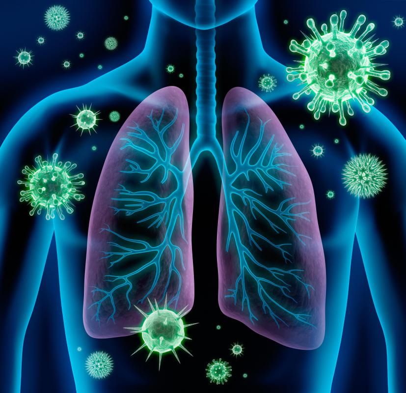 What are the Best Acute Bronchitis Treatments? (with pictures)