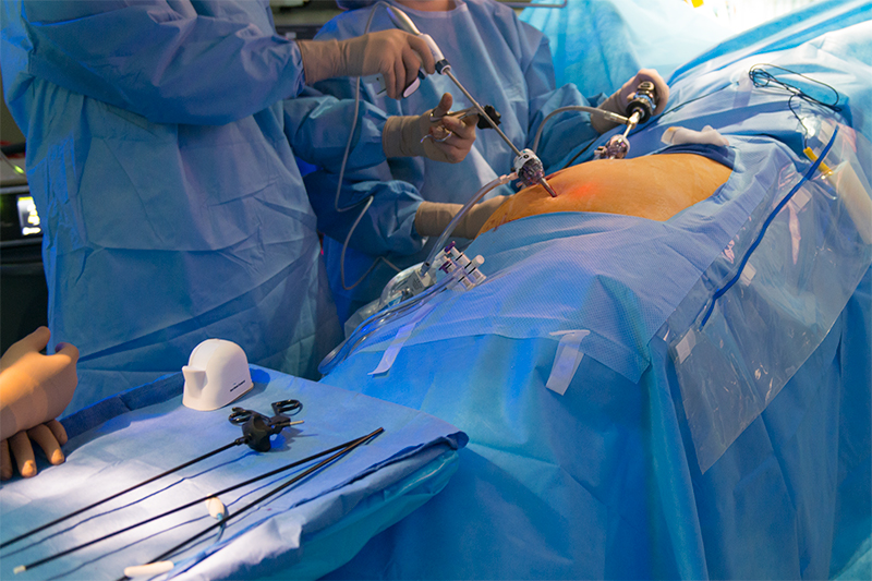 Laparoscopic Adrenalectomy Laparoscopic.MD