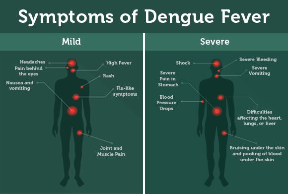 What Is Dengue Fever? Mosquito Borne Diseases