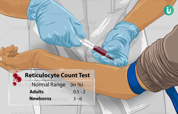 Reticulocyte Count Test Procedure, Purpose, Results, Normal range