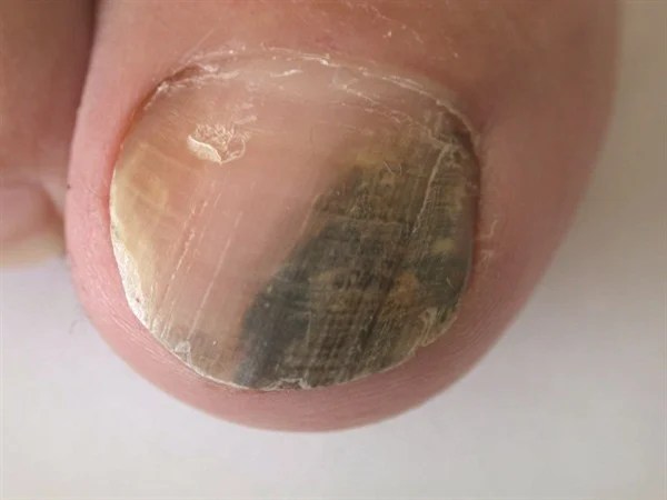 NAILS' 10 MostViewed Questions Answered Style NAILS Magazine