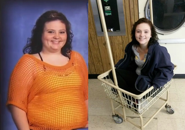 Ohio Teen Undergoes LifeSaving Weight Loss Surgery ObesityHelp