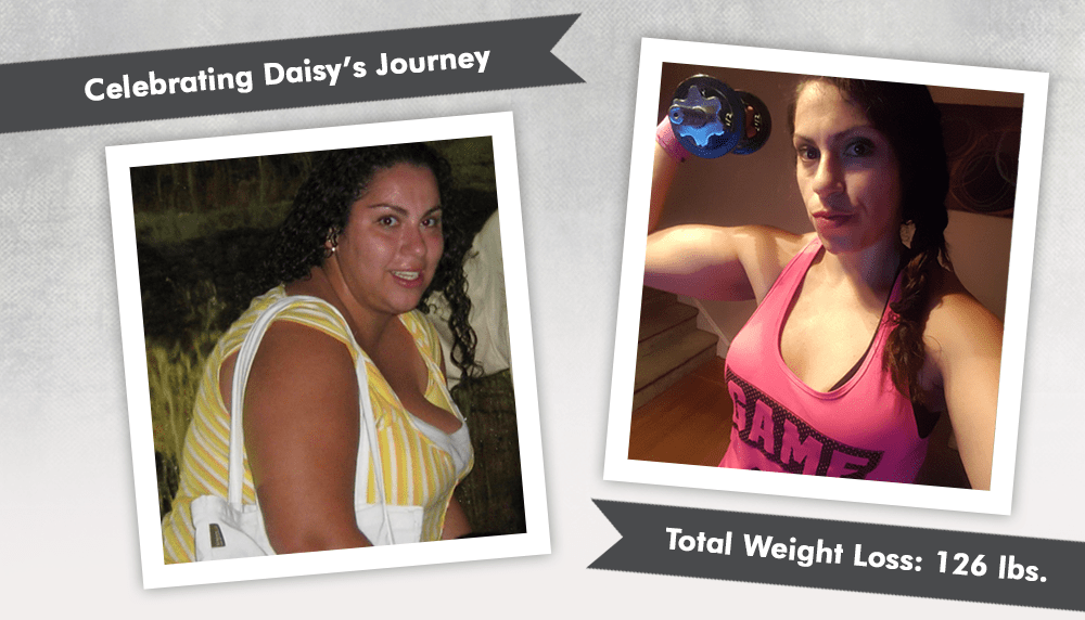 Before & After RNY with Daisy ObesityHelp