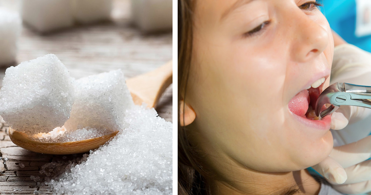Hundreds Of Children Are Having 'Rotting Teeth' Removed