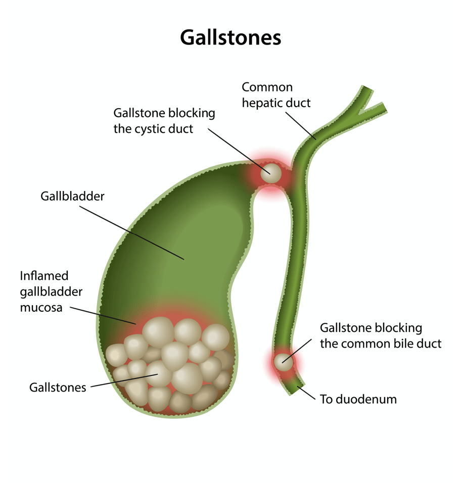 Why Bile Matters — Pamela Grant, L.Ac, NTP