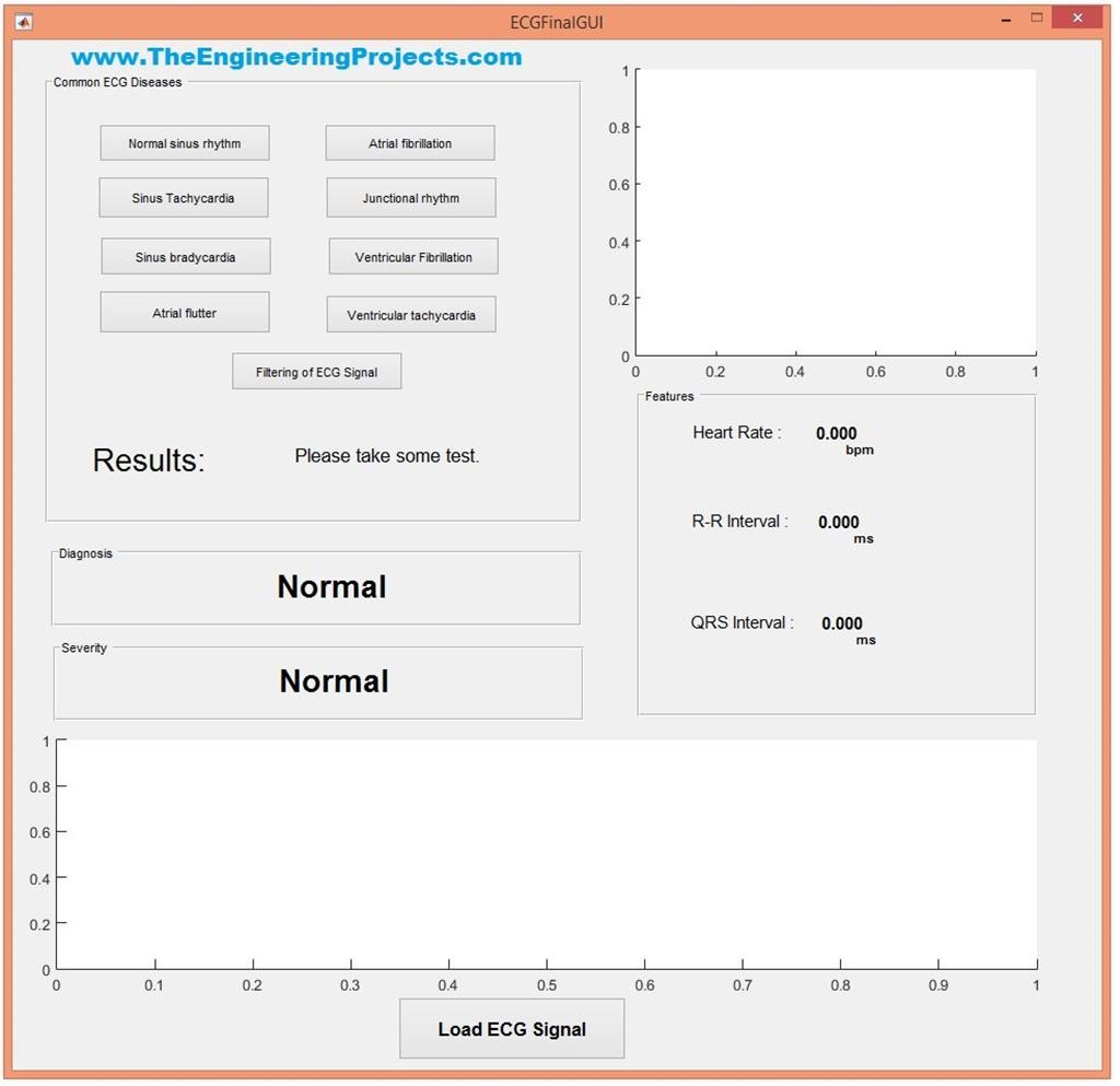 ECG Simulation using MATLAB The Engineering Projects