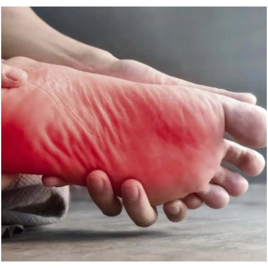 Health Tips There is burning and itching in the soles of feet in