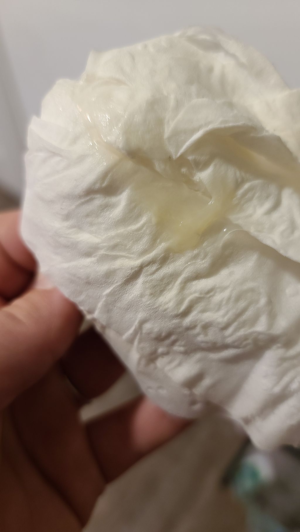 Weeks And Yellow Tinted Mucus (photo Included), 41 OFF