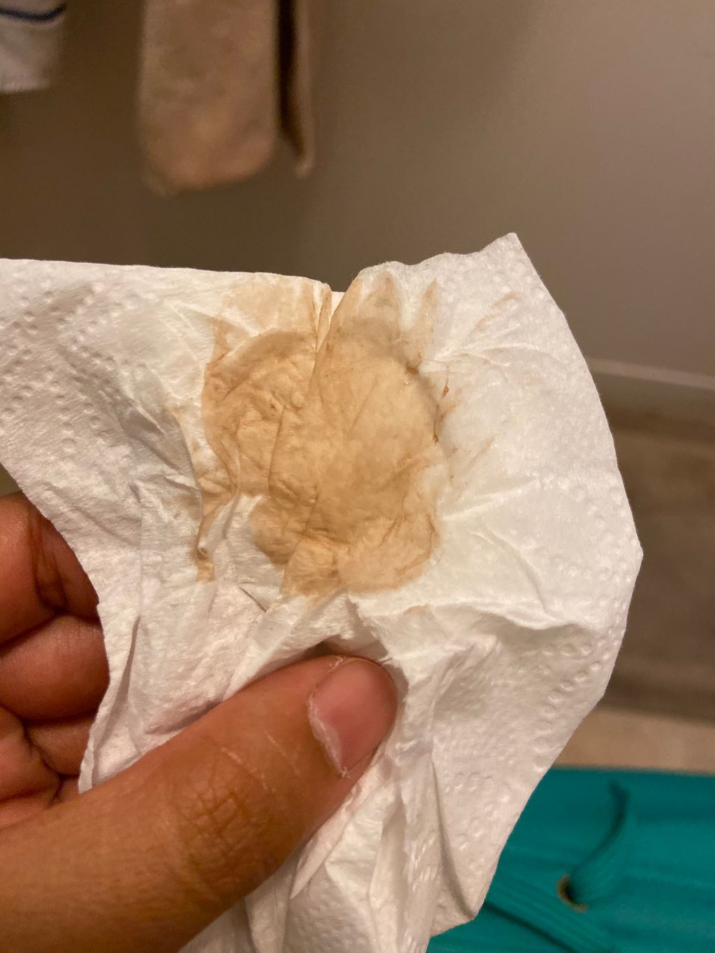 Light Brown Discharge Before Period