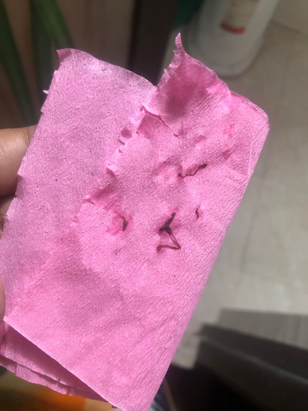 brown discharge at 5 weeks Trying to Conceive Forums What to Expect