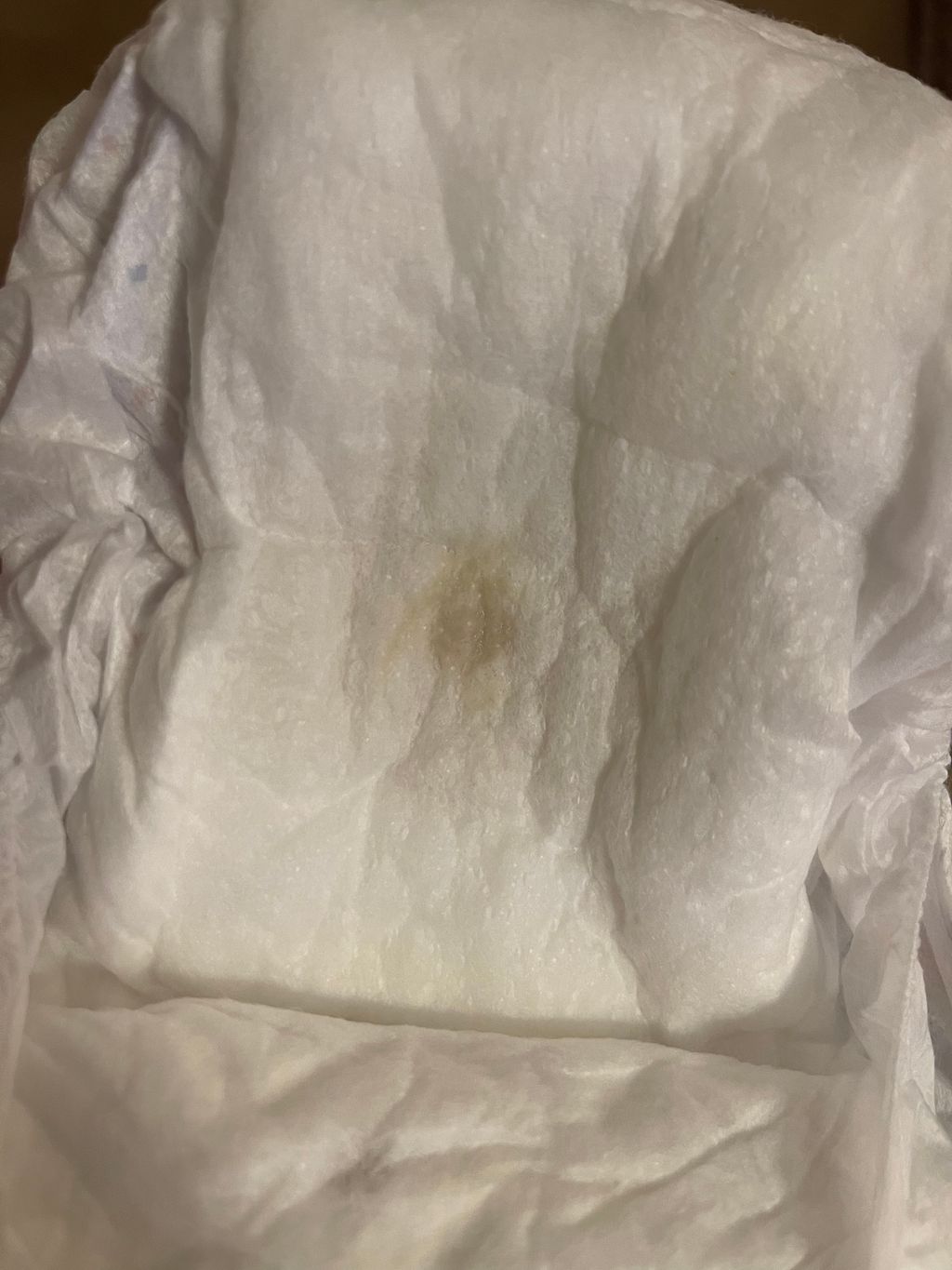 Discharge in Diaper December 2023 Babies Forums What to Expect