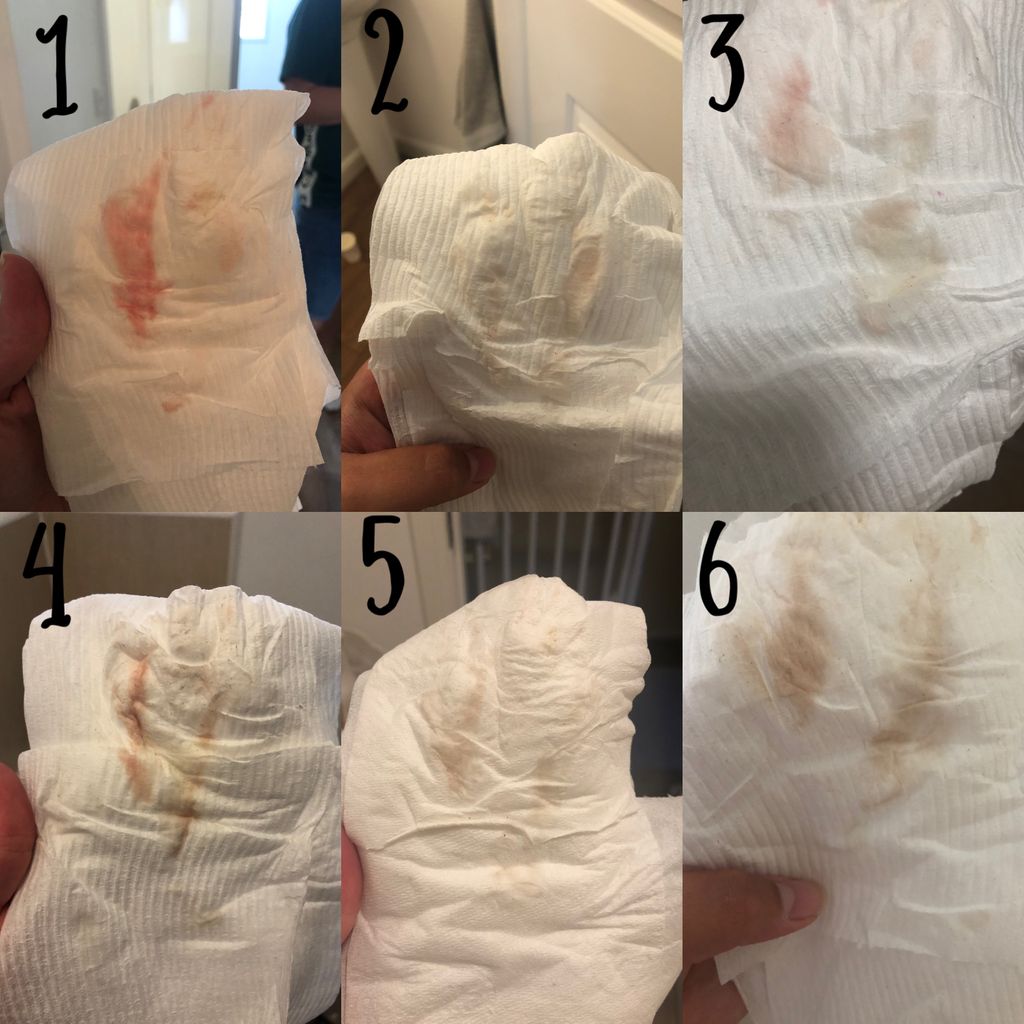 Tmi.... Is This Implantation Bleeding? - Trying To Conceive | Forums | What To Expect
