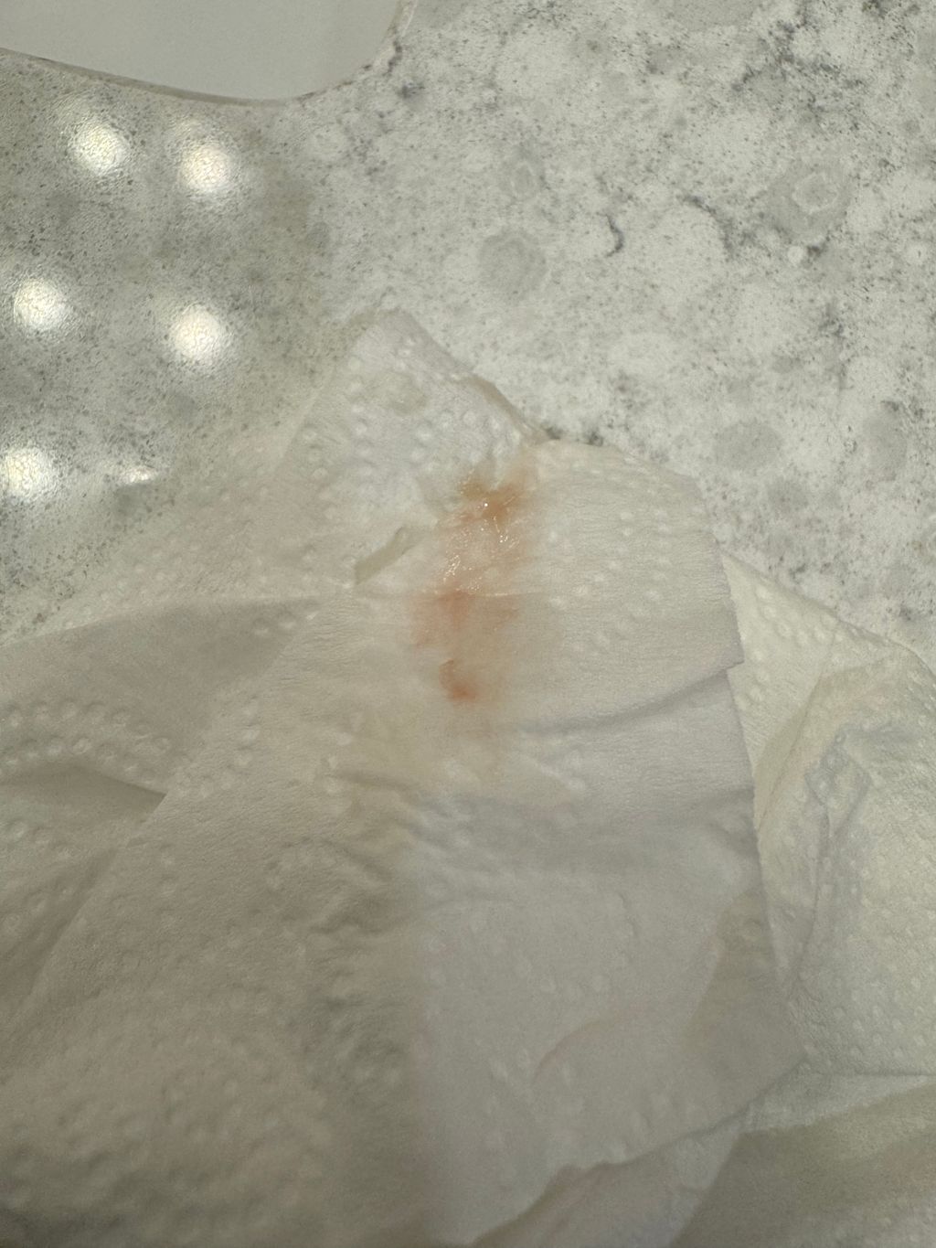 Implantation spotting at 12 DPO?? Pics attached. July 2025 Babies