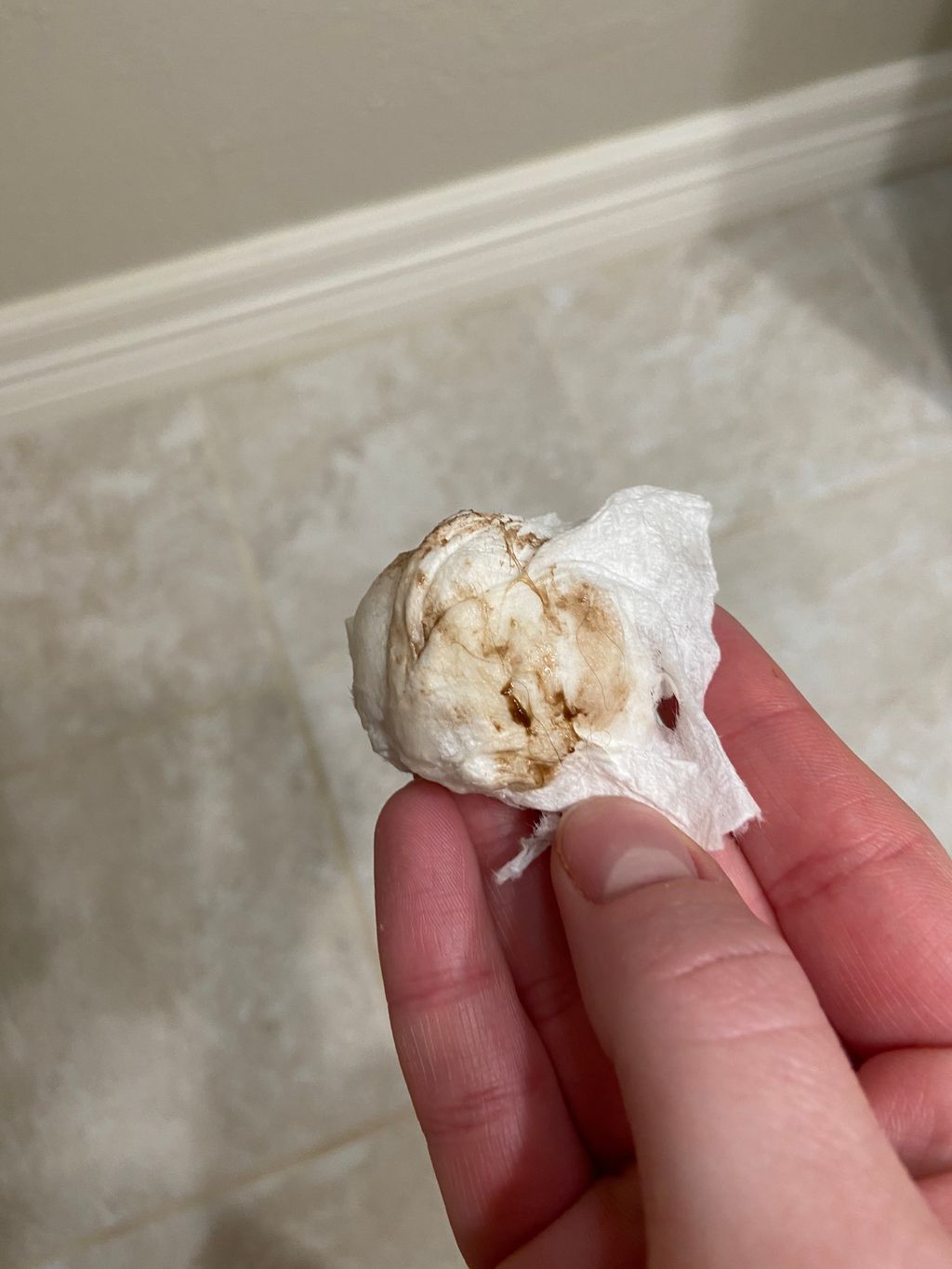 Dark brown discharge miscarriage? (Warningpics) 1st Pregnancy