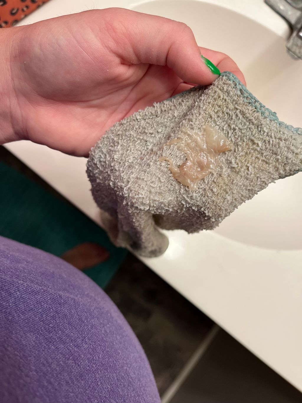 36+4 losing mucus plug - June 2024 Babies | Forums | What to Expect