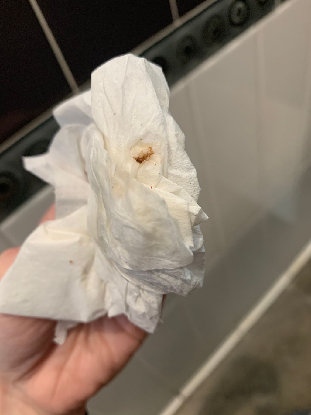 What Does Implantation Bleeding Look Like When You Wipe