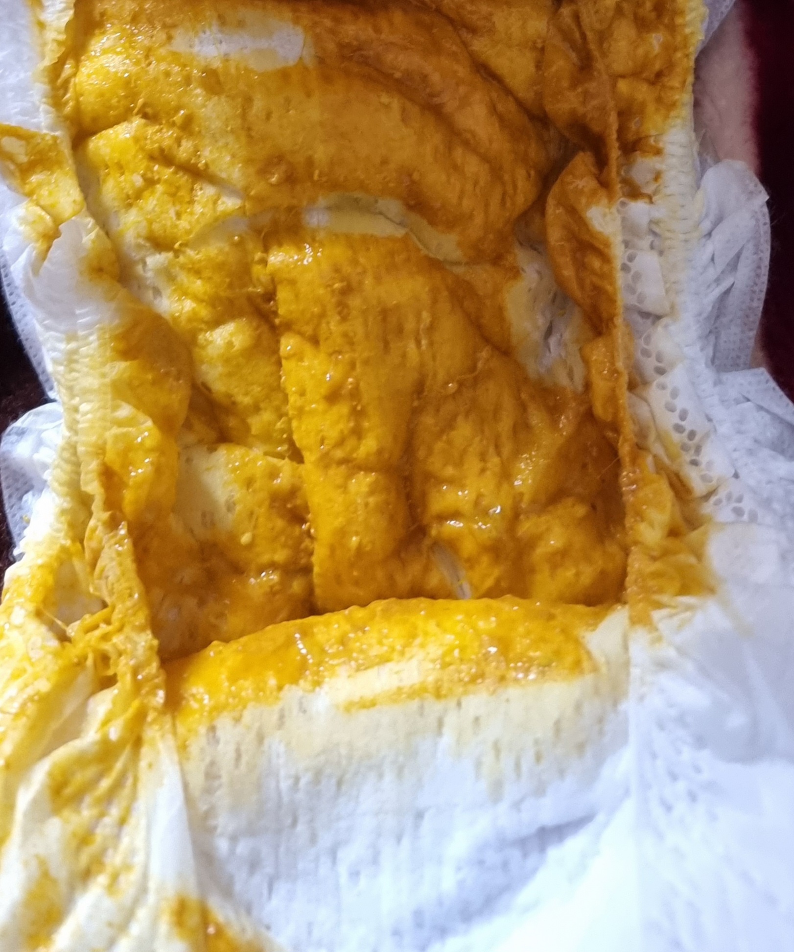 Warning Pic! TMI Mucus in poop?? Dairy intolerance?? December 2018