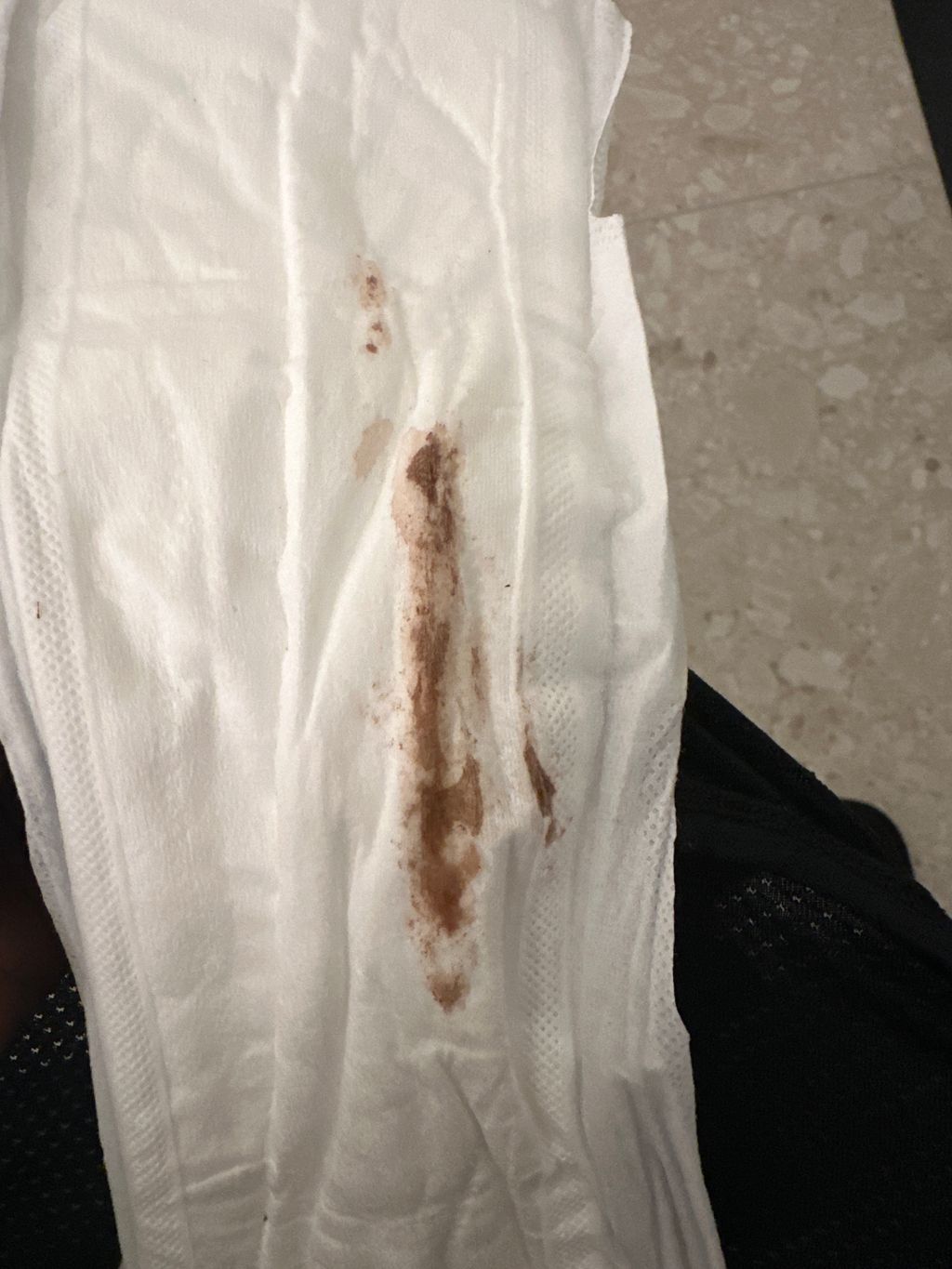 *Pic added* Brown spotting, UTI, nervous.. Spotting/discharge early