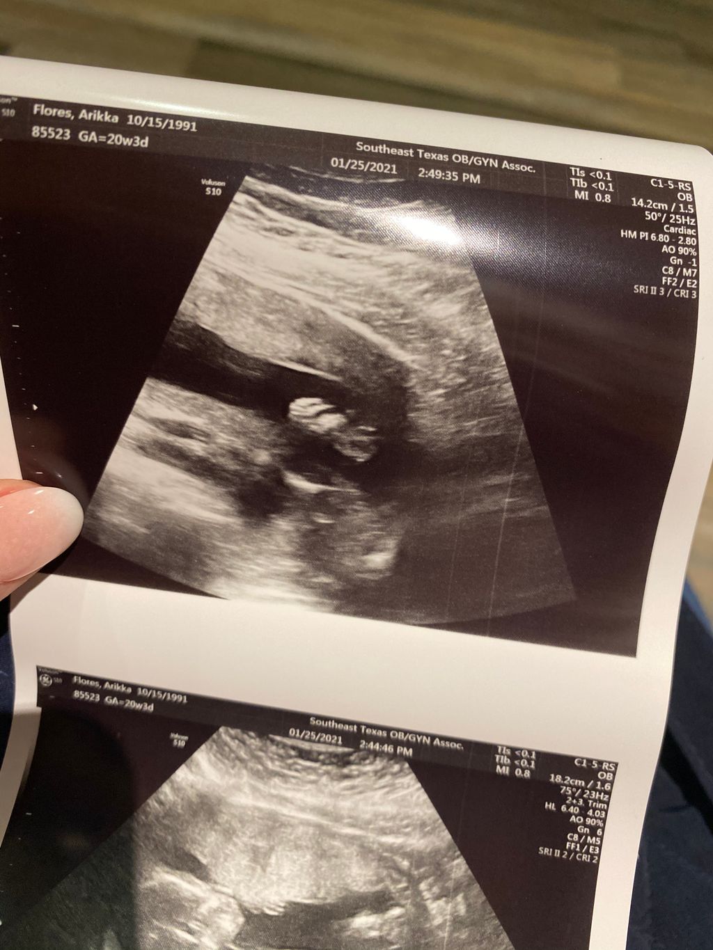 how to spot a fake baby ultrasound Merlin Hastings(02)