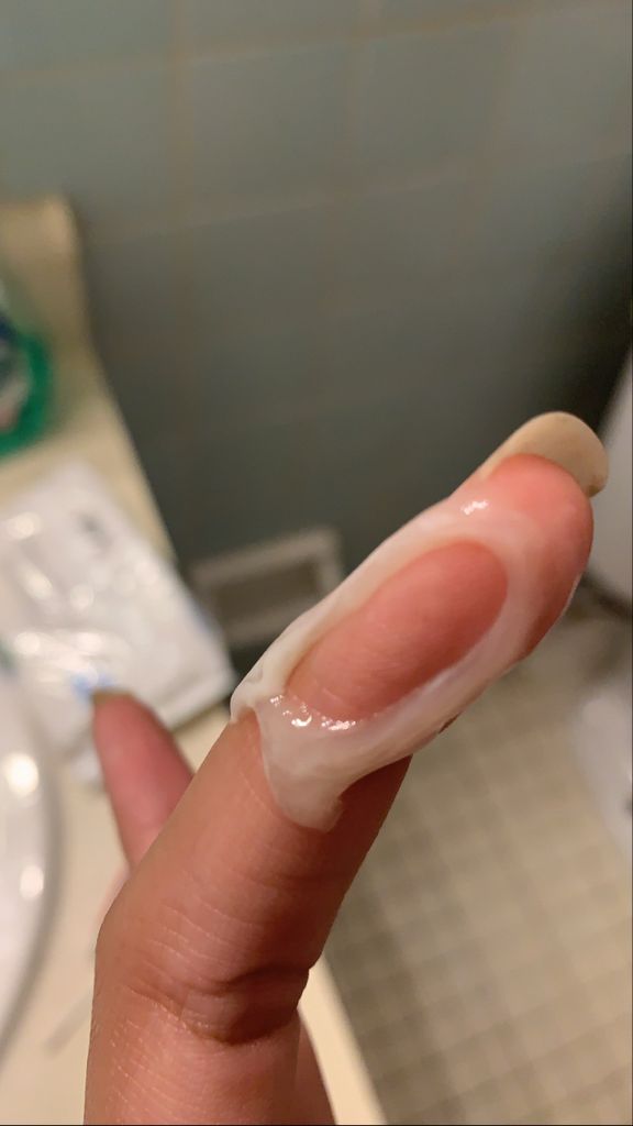 Help ! Is This My Mucus Plug ? Graphic - May 2020 Babies | Forums | What To Expect