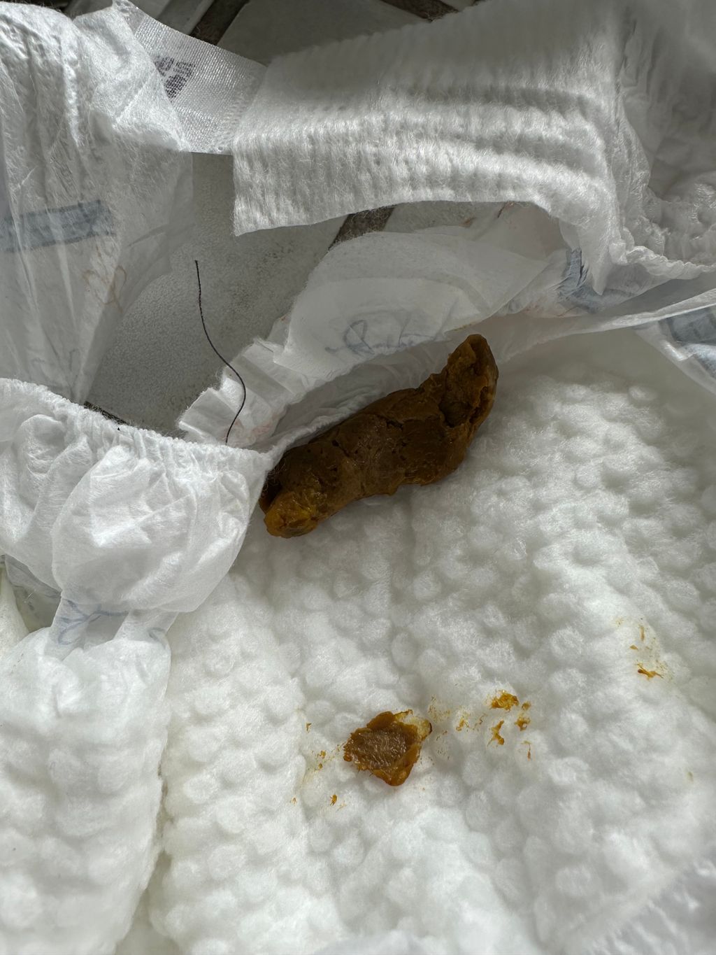 Poop after solids (**pic**) September 2023 Babies Forums What to