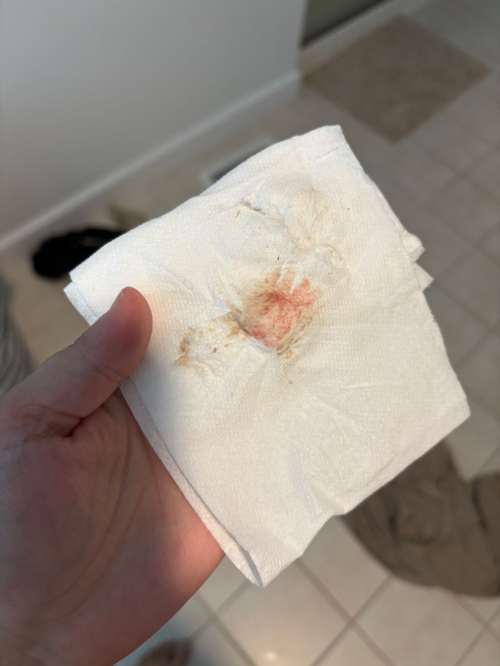 HELP TMI implantation bleeding or period?? Early pregnancy symptoms